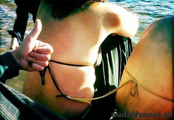 Pozor na letné žartíky